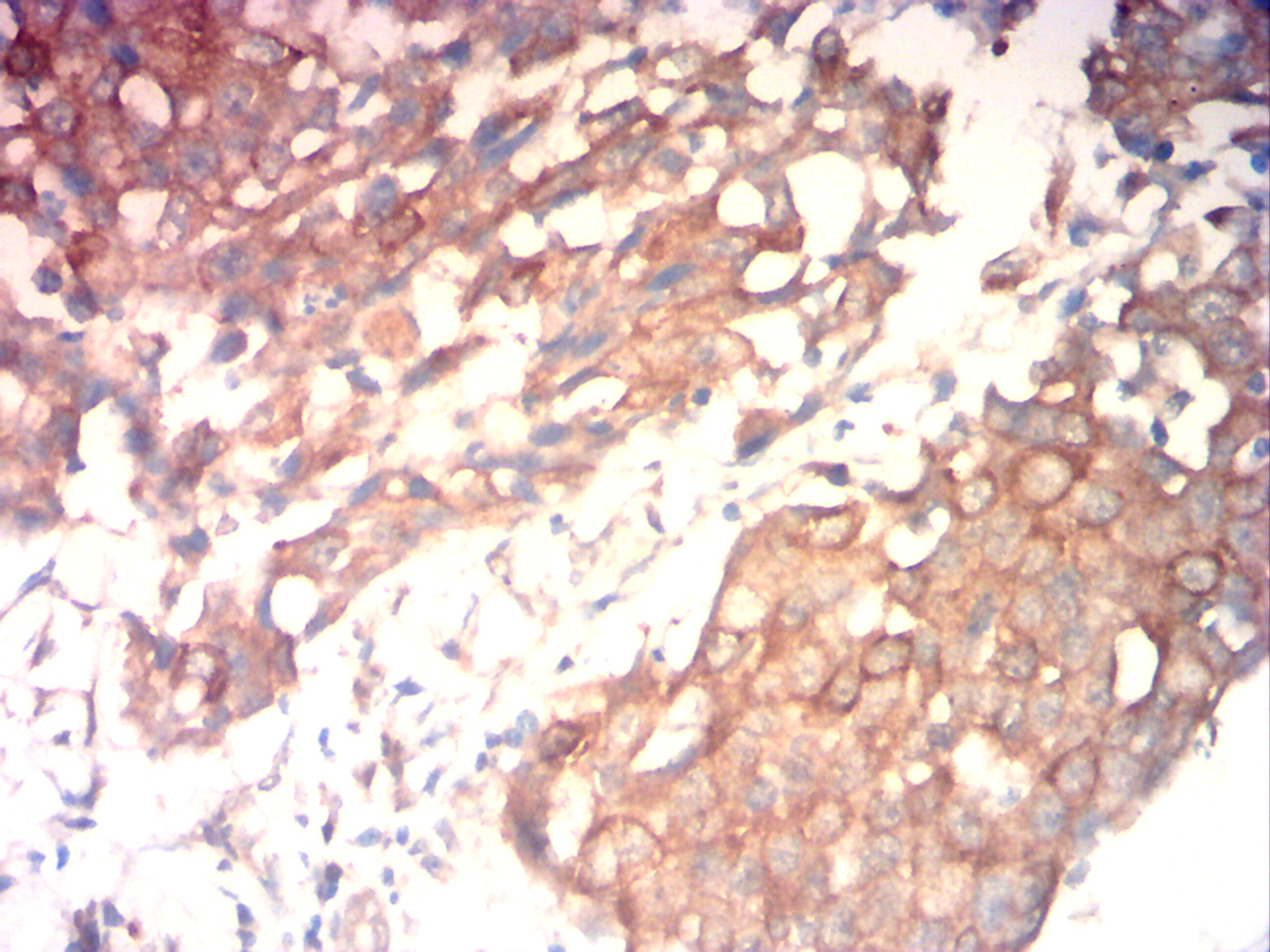 IHC